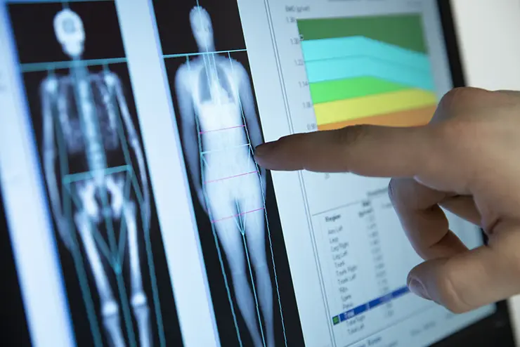 a computer screen featuring a full body imaging scan