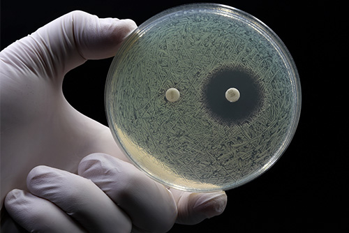 Penicillin was discovered in 1928